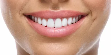 smiling lady showing her teeth