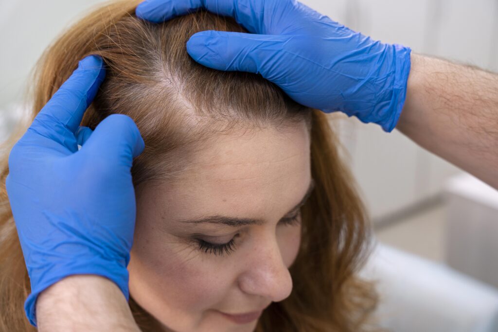 woman having a medical consultation due to hair loss