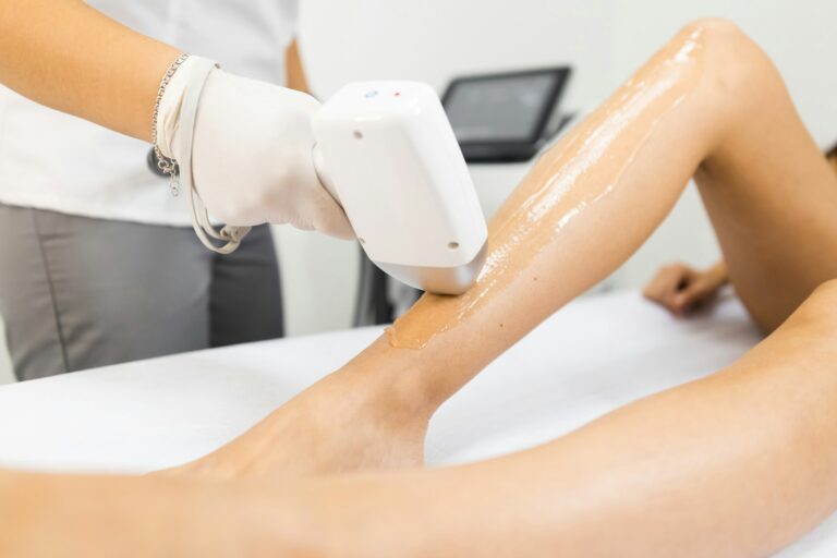 Laser Hair Removal