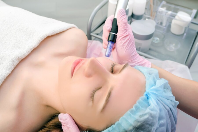 Microneedling