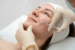 Microneedling