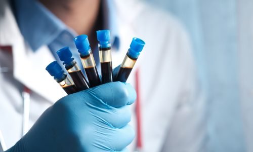 hand in blue medical gloves holding blood test tube white sited
