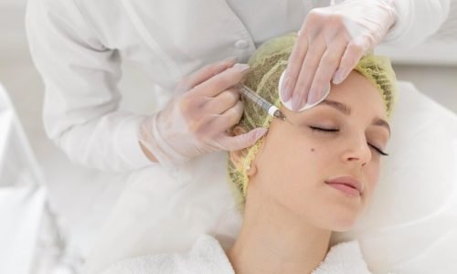 micro needling procedure